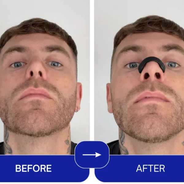 EasyBreathe – Mágneses orrcsíkok (15 db) slider