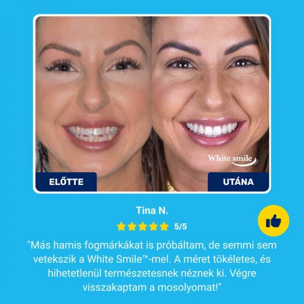 True Smile – Mű Fogak a tökéletes mosolyhoz slider