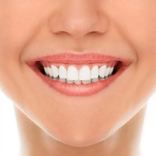 True Smile – Mű Fogak a tökéletes mosolyhoz slider